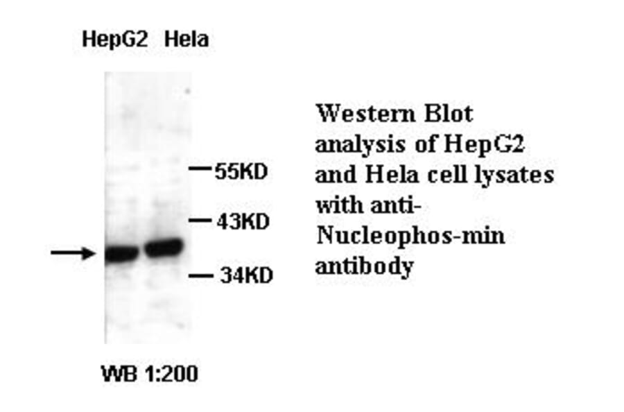 Nucleophosmin Antibody from Signalway Antibody (39296) - Antibodies.com