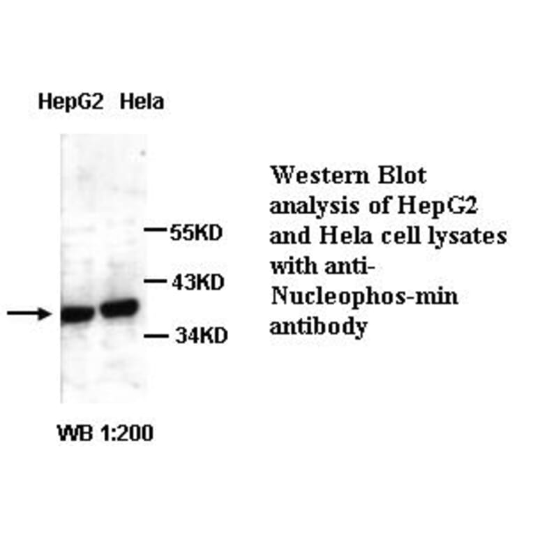 Nucleophosmin Antibody from Signalway Antibody (39296) - Antibodies.com