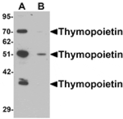 Western blot - Thymopoietin Antibody from Signalway Antibody (25390) - Antibodies.com