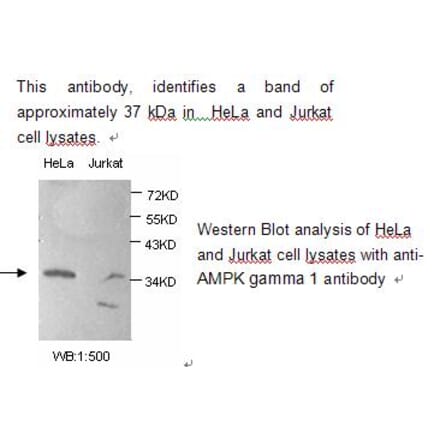 AMPK gamma 1 Antibody from Signalway Antibody (39217) - Antibodies.com