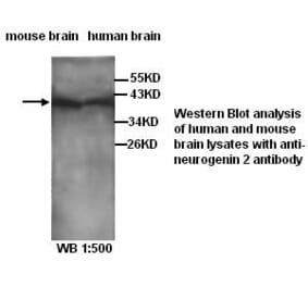 neurogenin 2 Antibody from Signalway Antibody (39281) - Antibodies.com