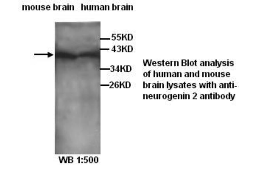 neurogenin 2 Antibody from Signalway Antibody (39281) - Antibodies.com