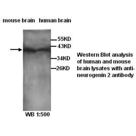 neurogenin 2 Antibody from Signalway Antibody (39281) - Antibodies.com