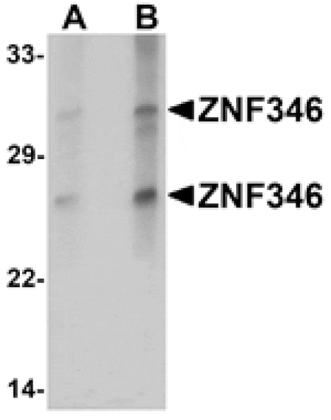 Western blot - ZNF346 (CT) Antibody from Signalway Antibody (25268) - Antibodies.com