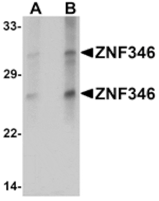 Western blot - ZNF346 (CT) Antibody from Signalway Antibody (25268) - Antibodies.com