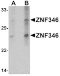 Western blot - ZNF346 (CT) Antibody from Signalway Antibody (25268) - Antibodies.com