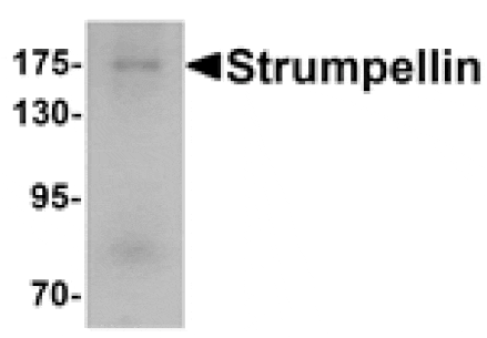 Western blot - Strumpellin Antibody from Signalway Antibody (25361) - Antibodies.com