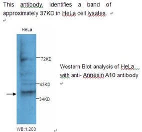 Annexin A10 Antibody from Signalway Antibody (39230) - Antibodies.com
