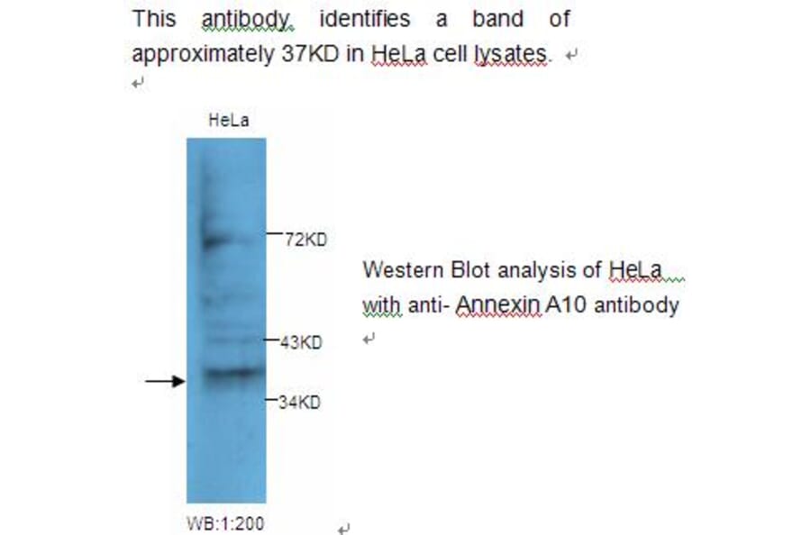 Annexin A10 Antibody from Signalway Antibody (39230) - Antibodies.com