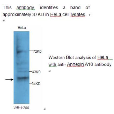 Annexin A10 Antibody from Signalway Antibody (39230) - Antibodies.com