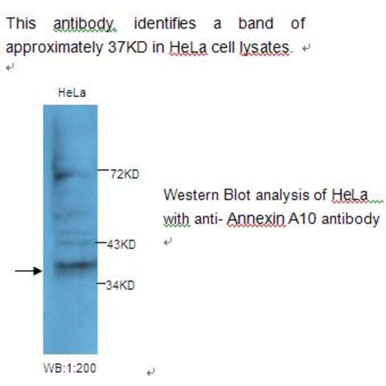 Annexin A10 Antibody from Signalway Antibody (39230) - Antibodies.com