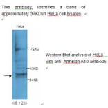 Annexin A10 Antibody from Signalway Antibody (39230) - Antibodies.com