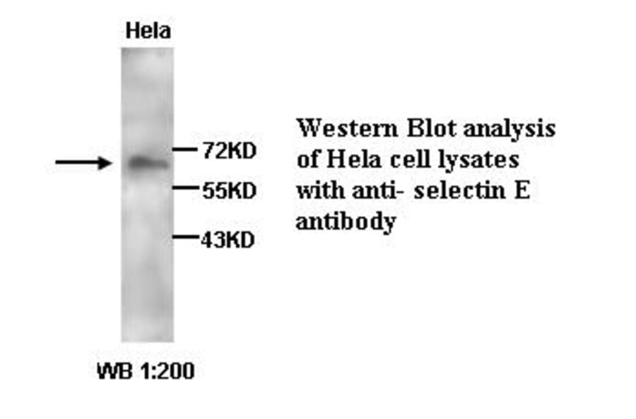 selectin E Antibody from Signalway Antibody (39258) - Antibodies.com