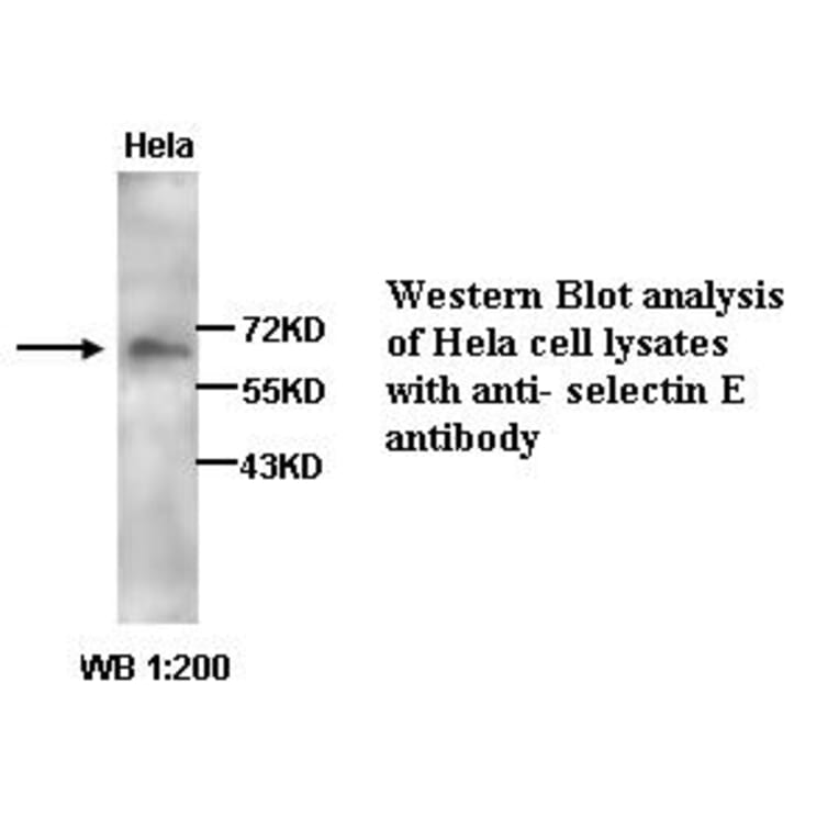 selectin E Antibody from Signalway Antibody (39258) - Antibodies.com