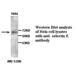 selectin E Antibody from Signalway Antibody (39258) - Antibodies.com