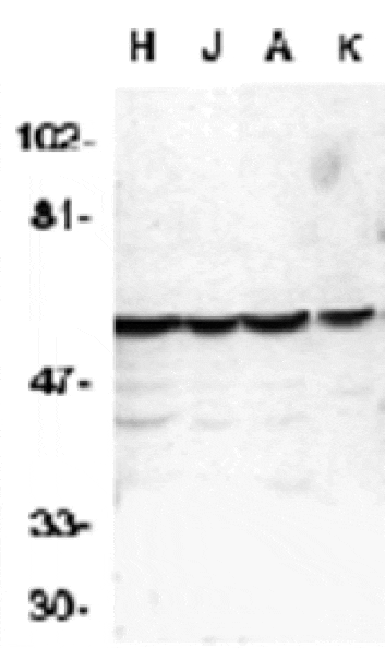 Western blot - Caspase-10 Antibody from Signalway Antibody (24016) - Antibodies.com