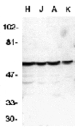 Western blot - Caspase-10 Antibody from Signalway Antibody (24016) - Antibodies.com