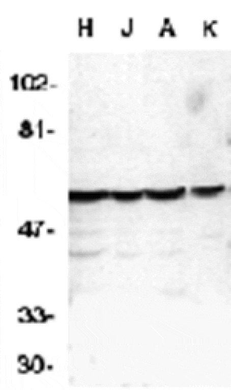 Western blot - Caspase-10 Antibody from Signalway Antibody (24016) - Antibodies.com