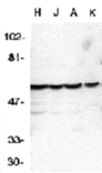 Western blot - Caspase-10 Antibody from Signalway Antibody (24016) - Antibodies.com