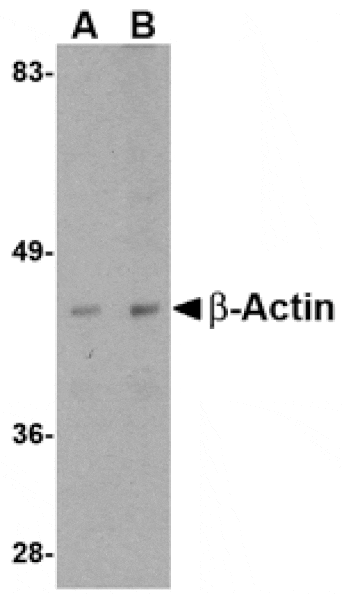 Western blot - Beta-actin Antibody from Signalway Antibody (24831) - Antibodies.com