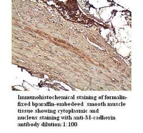 M-cadherin Antibody from Signalway Antibody (39253) - Antibodies.com