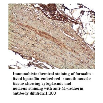 M-cadherin Antibody from Signalway Antibody (39253) - Antibodies.com