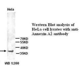 Annexin A2 Antibody from Signalway Antibody (39291) - Antibodies.com