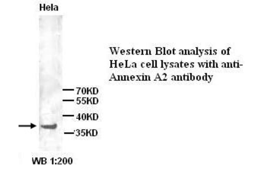 Annexin A2 Antibody from Signalway Antibody (39291) - Antibodies.com