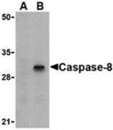 Western blot - Caspase-8 Antibody from Signalway Antibody (24297) - Antibodies.com