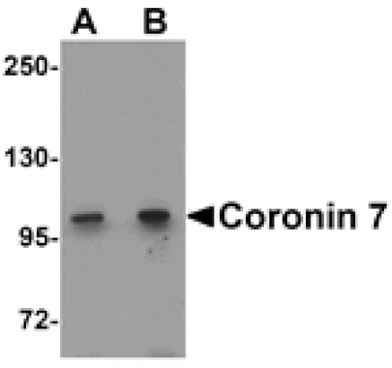 Western blot - Coronin 7 Antibody from Signalway Antibody (25345) - Antibodies.com