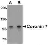 Western blot - Coronin 7 Antibody from Signalway Antibody (25345) - Antibodies.com