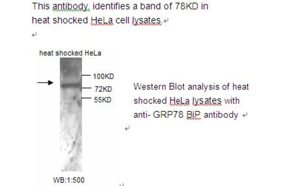 GRP78 Bip Antibody from Signalway Antibody (39220) - Antibodies.com