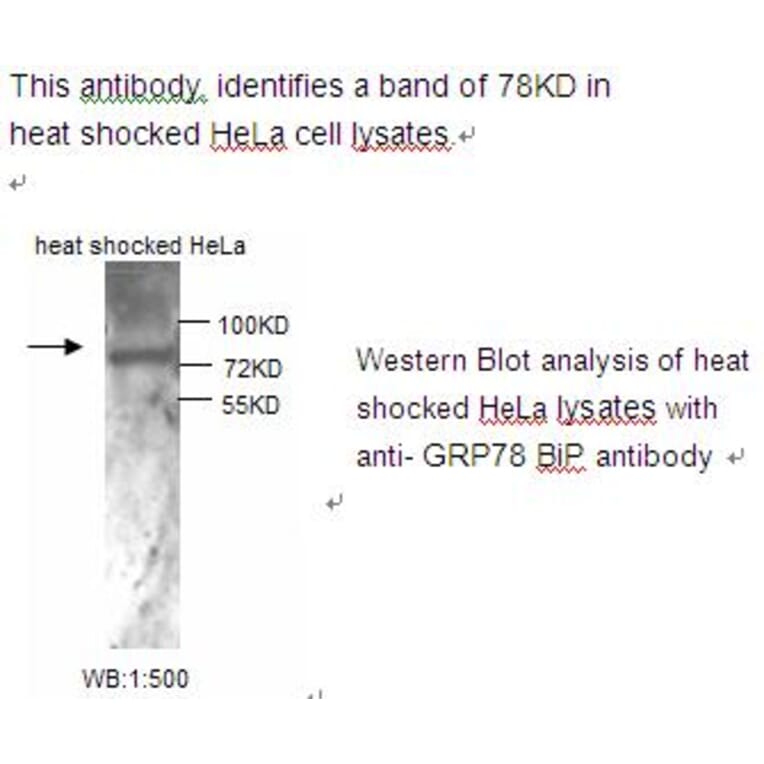 GRP78 Bip Antibody from Signalway Antibody (39220) - Antibodies.com