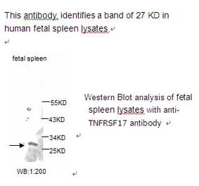 TNF RSF17 Antibody from Signalway Antibody (39225) - Antibodies.com