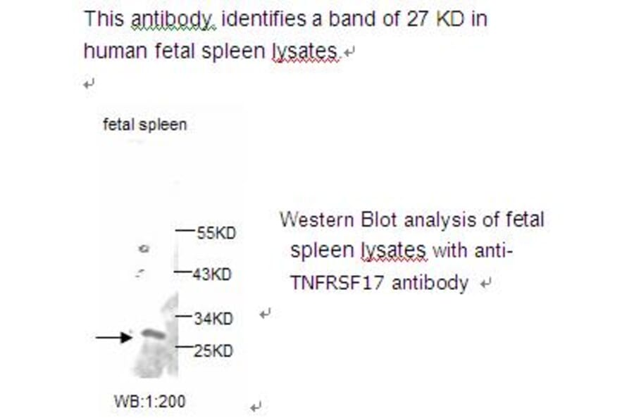TNF RSF17 Antibody from Signalway Antibody (39225) - Antibodies.com
