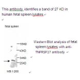 TNF RSF17 Antibody from Signalway Antibody (39225) - Antibodies.com