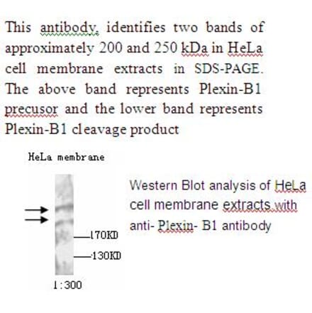 Plexin B1 Antibody from Signalway Antibody (39234) - Antibodies.com