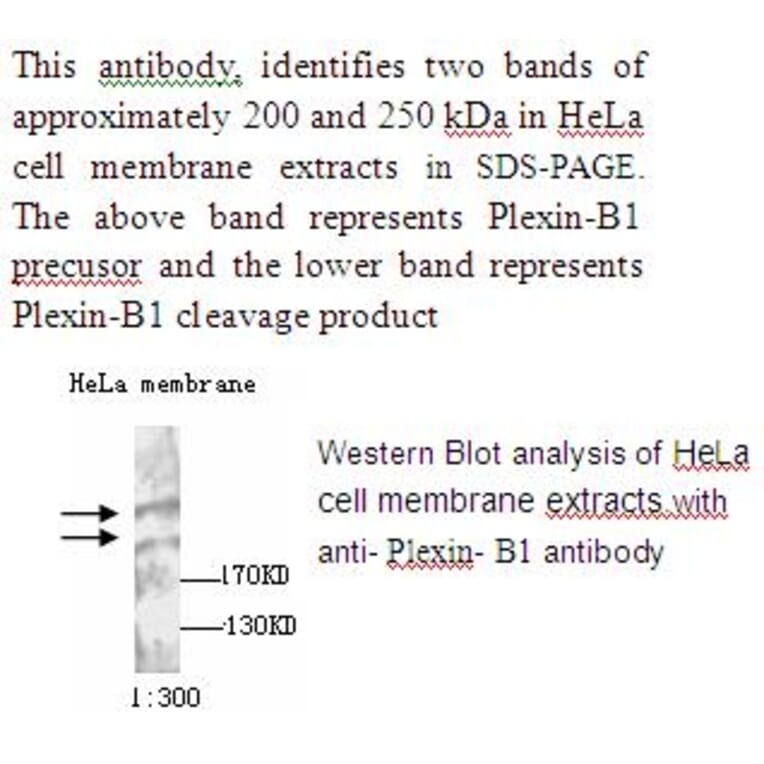 Plexin B1 Antibody from Signalway Antibody (39234) - Antibodies.com