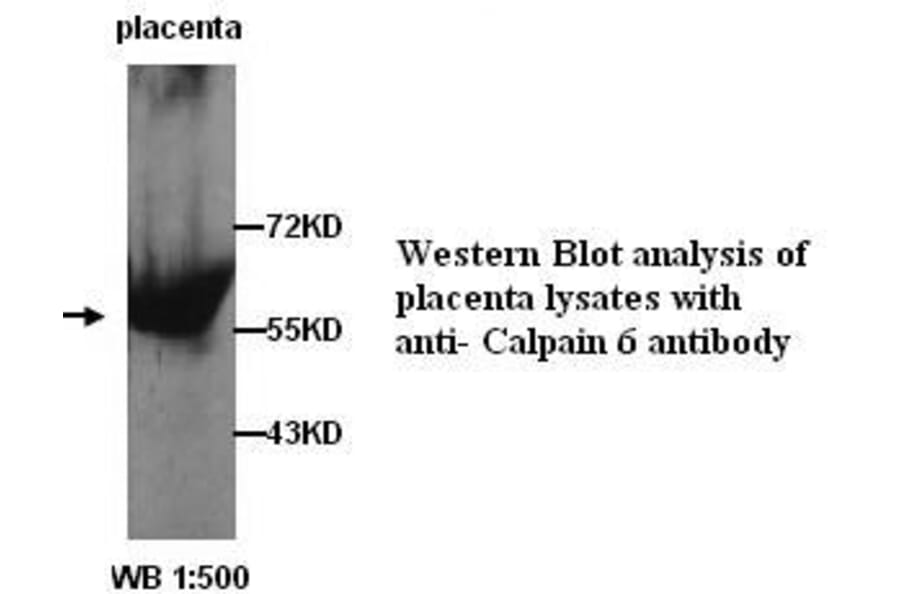 Calpain 6 Antibody from Signalway Antibody (39254) - Antibodies.com