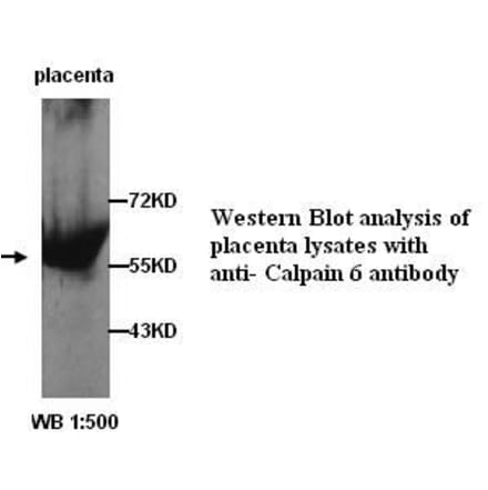 Calpain 6 Antibody from Signalway Antibody (39254) - Antibodies.com