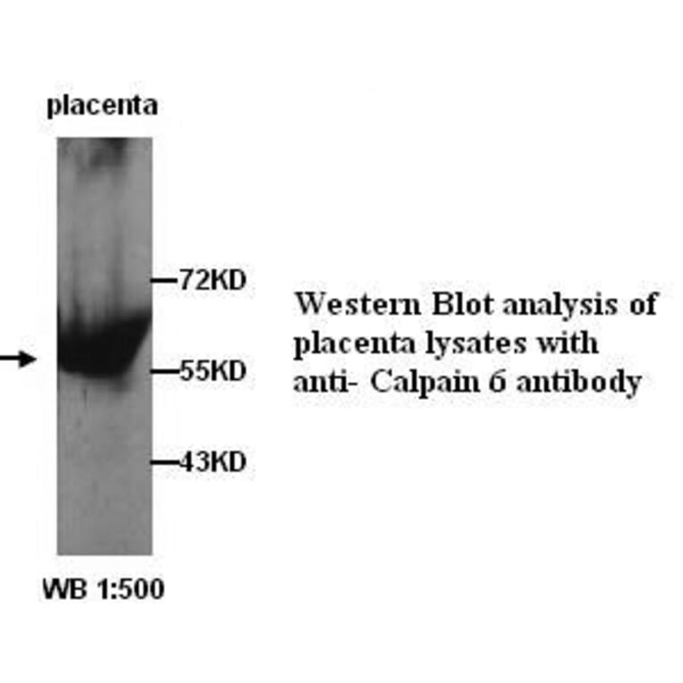 Calpain 6 Antibody from Signalway Antibody (39254) - Antibodies.com