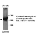 Calpain 6 Antibody from Signalway Antibody (39254) - Antibodies.com