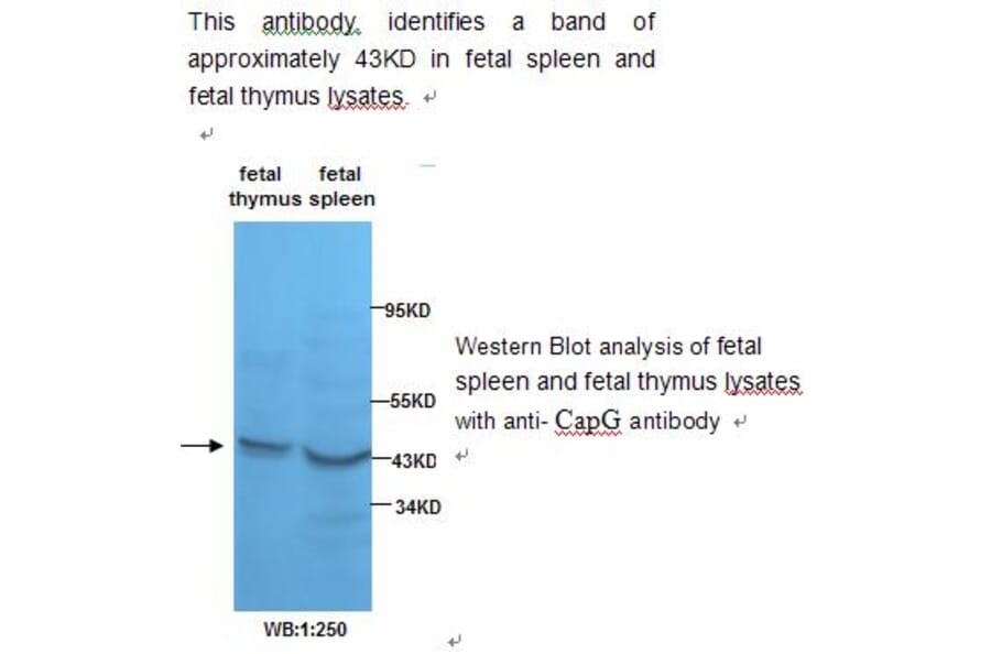 Actin Regulatory Protein CAPG Antibody from Signalway Antibody (39232) - Antibodies.com