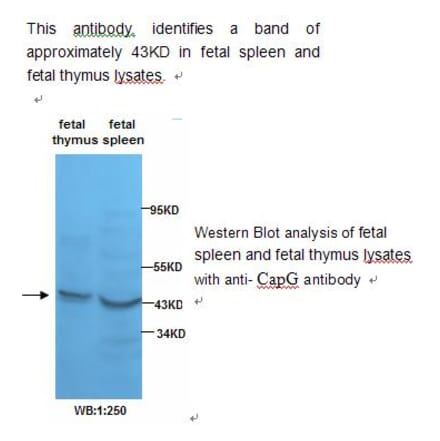 Actin Regulatory Protein CAPG Antibody from Signalway Antibody (39232) - Antibodies.com