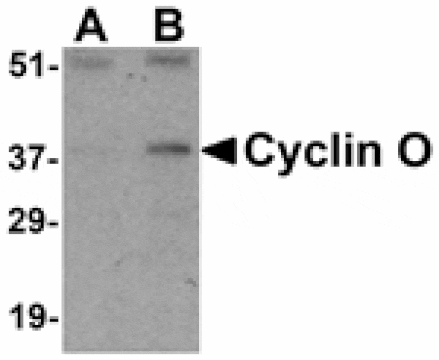 Western blot - Cyclin O Antibody from Signalway Antibody (24429) - Antibodies.com