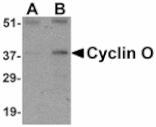 Western blot - Cyclin O Antibody from Signalway Antibody (24429) - Antibodies.com