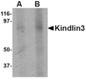 Western blot - KINDLIN3 Antibody from Signalway Antibody (24754) - Antibodies.com