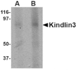 Western blot - KINDLIN3 Antibody from Signalway Antibody (24754) - Antibodies.com