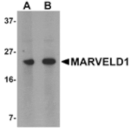Western blot - MARVELD1 Antibody from Signalway Antibody (25010) - Antibodies.com