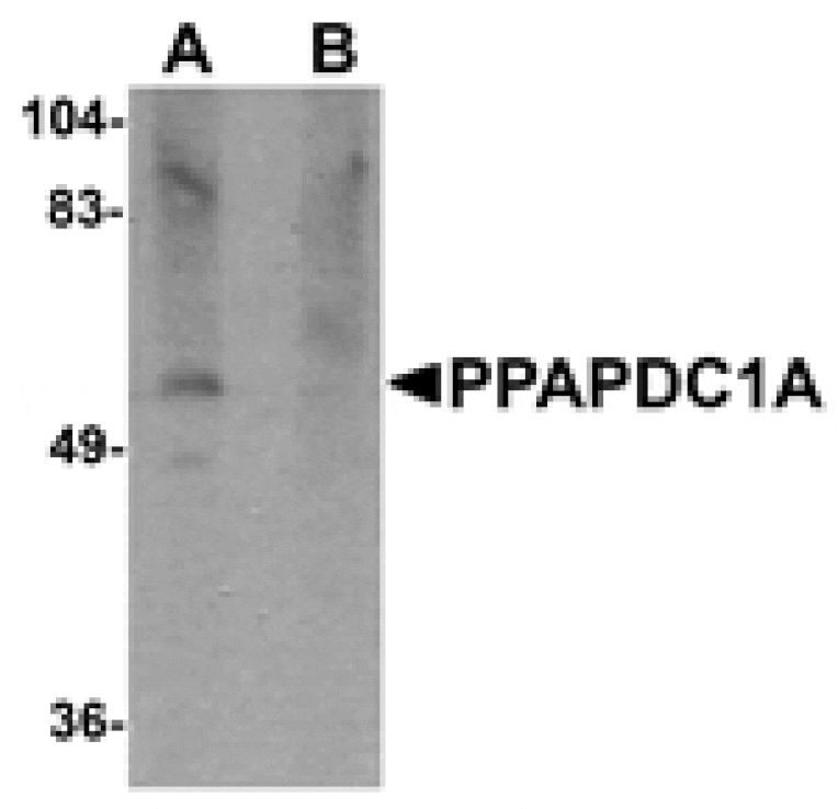 Western blot - PPAPDC1A Antibody from Signalway Antibody (25014) - Antibodies.com